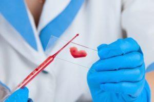 Hepatitis B Surface Antibody, Hepatitis B Specific Antigen w/ Confirmation and Hepatitis C Antibody, w/Confirmation